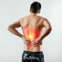 Spine Surgery in Mexico vs Canada - A Complete Comparison of Costs and Care